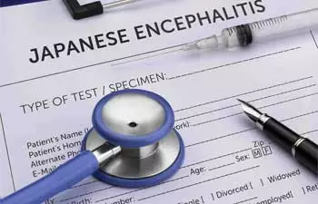 image of japanese encephalitis test